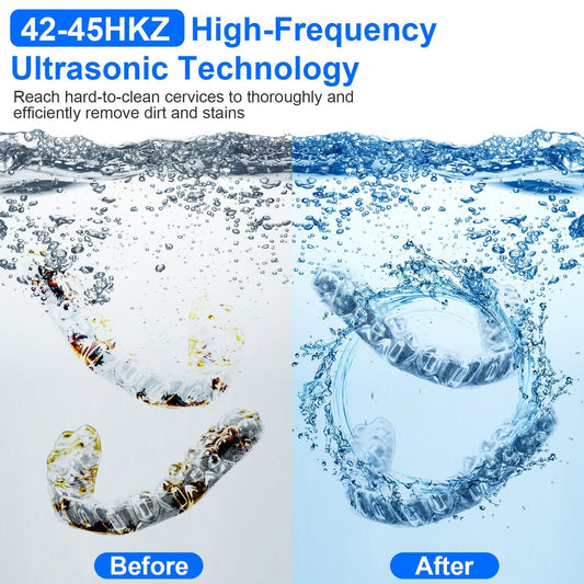 45kHz Ultrasonic Cleaning Machine With 3 Modes 230ML Capacity UV Light For Denture Mouth Guard Aligner Dental Trays Braces Rings Jewelry